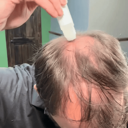 Bodywise Hair Growth Serum Roll-On™ | Fórmula Avanzada para el Crecimiento Capilar
